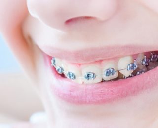 Qu’est ce que l’orthodontie